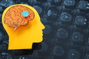 Top Picks For Brain Health Supplements